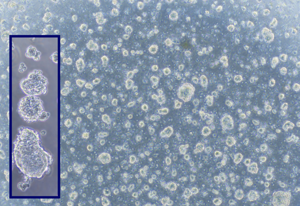 Forsea's organoids at record-breaking cell density.jpg